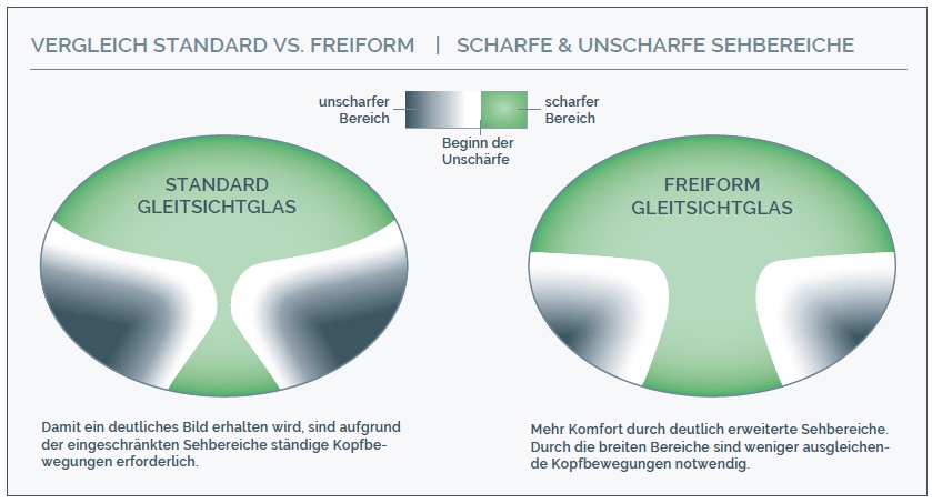 vergleich_freiform-standard