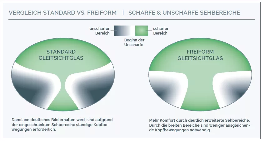 vergleich_freiform-standard